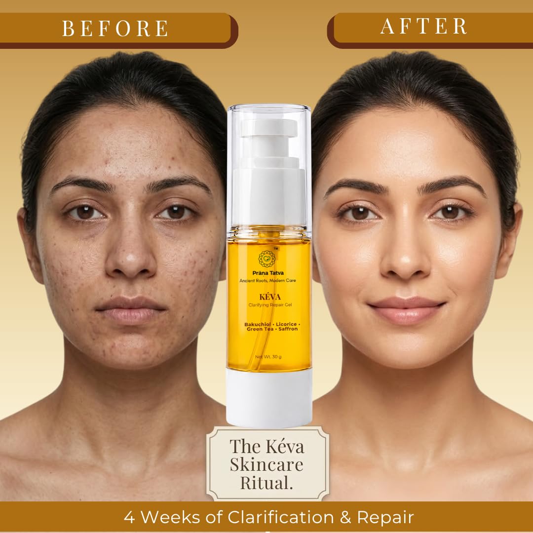 Prana Tatva Acne Repair Gel | Oil-Free Botanical Gel 30g
